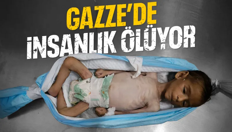 Gazze’de iki bebek daha açlığa yenik düştü