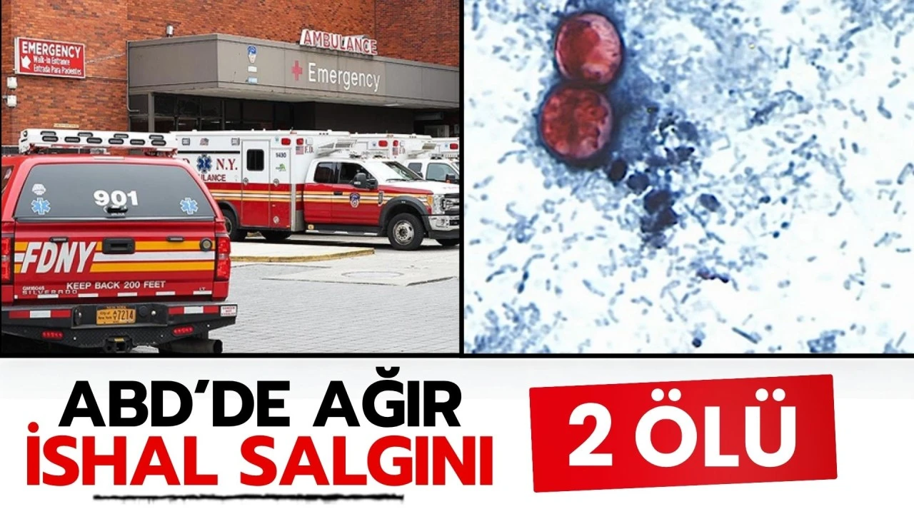 ABD'de 18 binin üzerinde kişinin yakalandığı 'siklosporiyazis' salgını: 2 kişi hayatını kaybetti