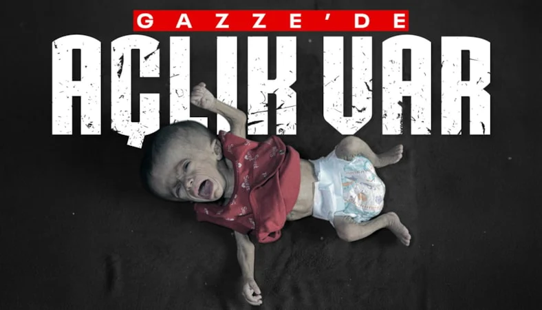 Gazze'de açlık: Filistinli bebeğin yaşam mücadelesi