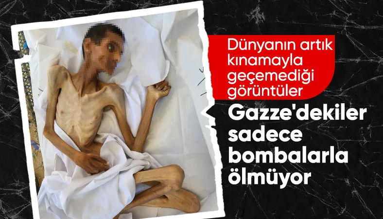 Açlık Gazze'de çocuk ve gençlerin kabusu oldu